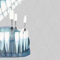 циркониева коронка цена - 21256 отстъпки