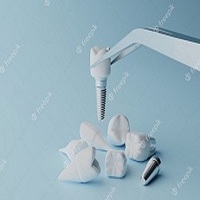 циркониева коронка цена - 94033 варианти
