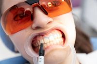 фасети - 25805 разновидности