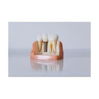 бондинг Варна - 96900 снимки | Dental Club бондинг Варна - 23215 снимки