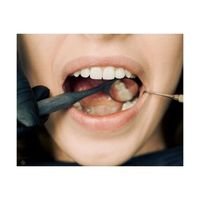 бондинг Варна - 6206 отстъпки бондинг Варна - 27873 отстъпки